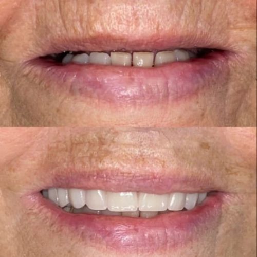 PROTOCOLO - MARIA DA PENHA -ID2170